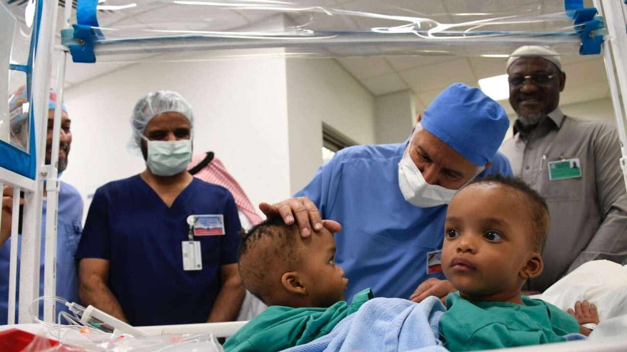 Nigerian conjoined twins successfully separated by Saudi surgeons