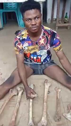 Anambra vigilantes arrest herbalist with 11 human bones